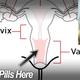 Illustration for article titled Woman In Traffic Stop Caught Smuggling Drugs In Her Vagina